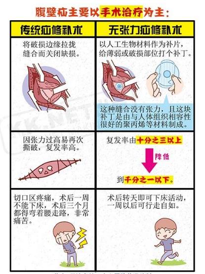 老年腹股沟疝气保守治疗有效方法,疝气中医治疗怎么锻炼有助于恢复