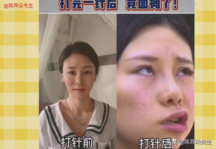 整容医院打瘦脸针过程,整形医院打瘦脸针没效果