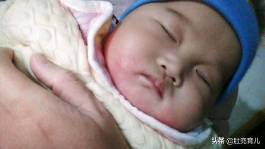 宝宝得了口水疹,宝宝得了口水疹怎么治疗