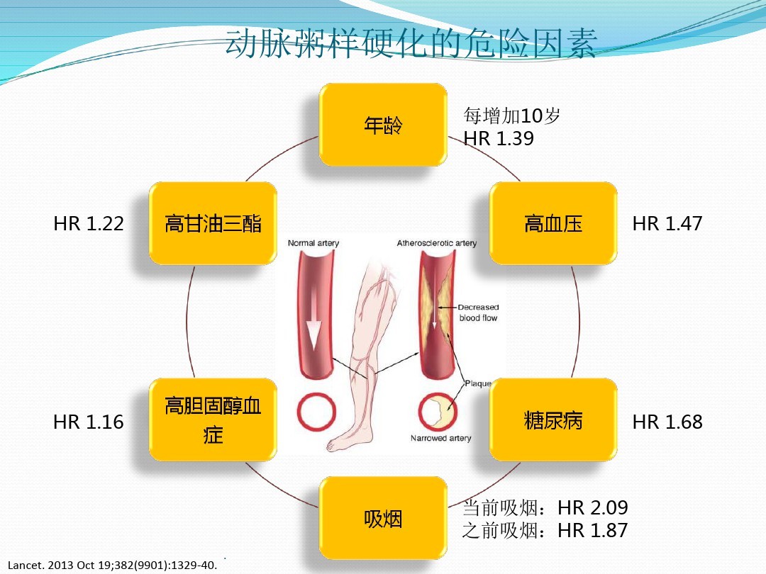 下肢动脉硬化闭塞中医什么科,老人下肢动脉硬化闭塞截肢