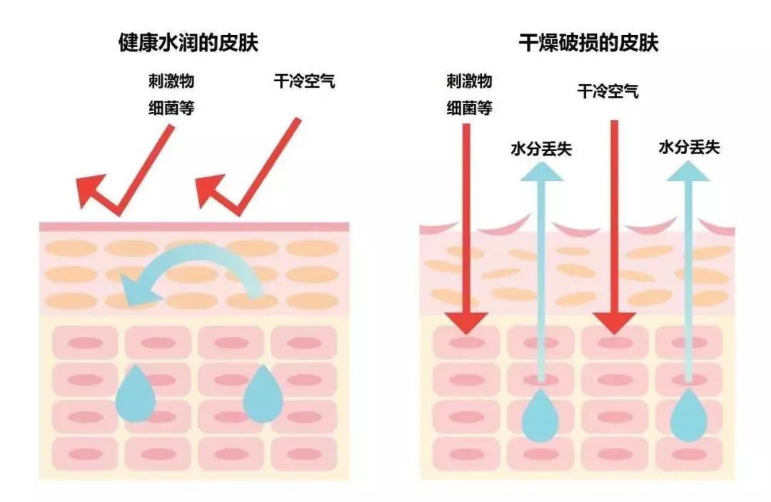 换季宝宝皮肤干痒敏感？专家支招，3步搞定