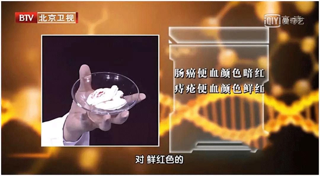 肠癌出现症状往往就是晚期吗,肠癌发现之前有哪些征兆