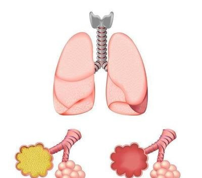 持续咳嗽会引起胸左下侧肋骨疼吗,持续咳嗽伴有胸痛是什么原因