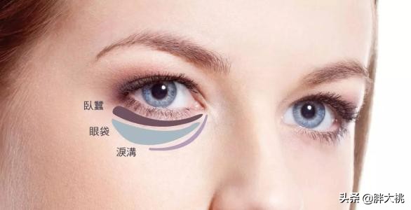 卧蚕和眼袋有啥不一样呢,卧蚕跟眼袋傻傻分不清