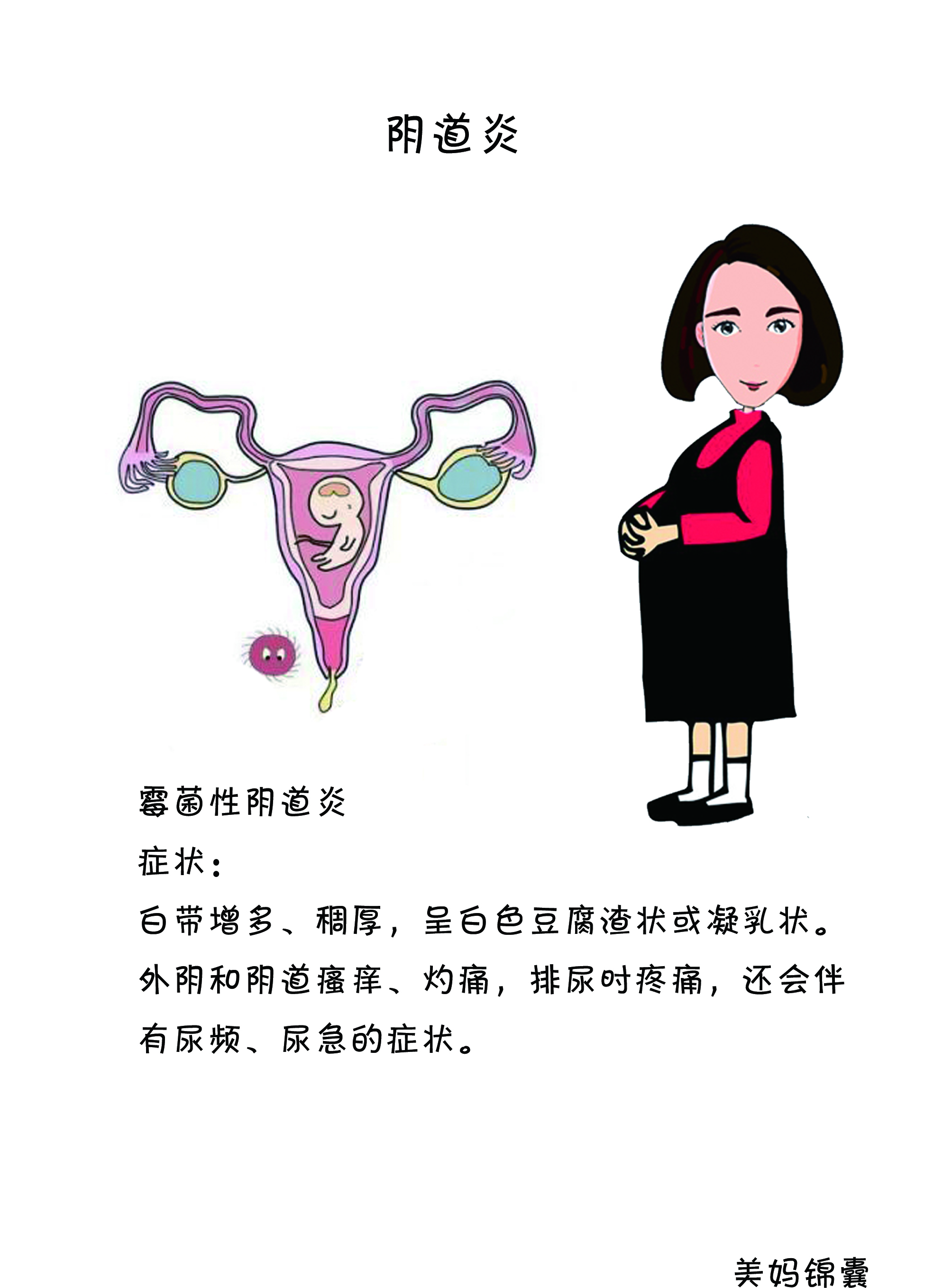 孕期阴道炎症状用什么药,孕期阴道炎症状怎么治疗