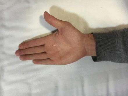 老年*皮人**肤瘙痒不用愁，按一穴炙一穴，皮肤不痒，精神也好了