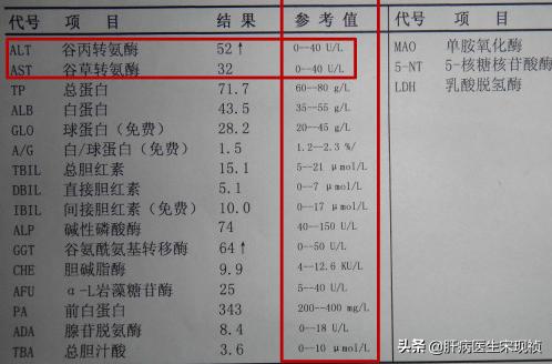 肝功白蛋白球蛋白偏高是什么意思,肝功能中的球蛋白偏高是什么意思