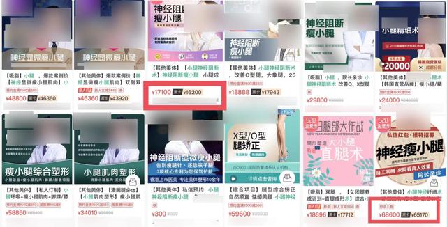 私密整容紧缩手术在中国合法吗,整容医院做私密收紧术要住院吗