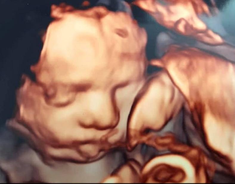 英国小孩患上怪病,英国1岁宝宝身患绝症