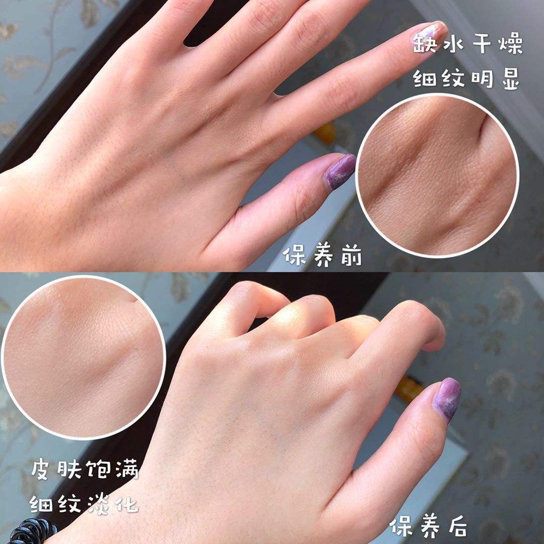 王凯手被投保3600万？林更新堵车时不忘涂手霜，我承认自己不精致