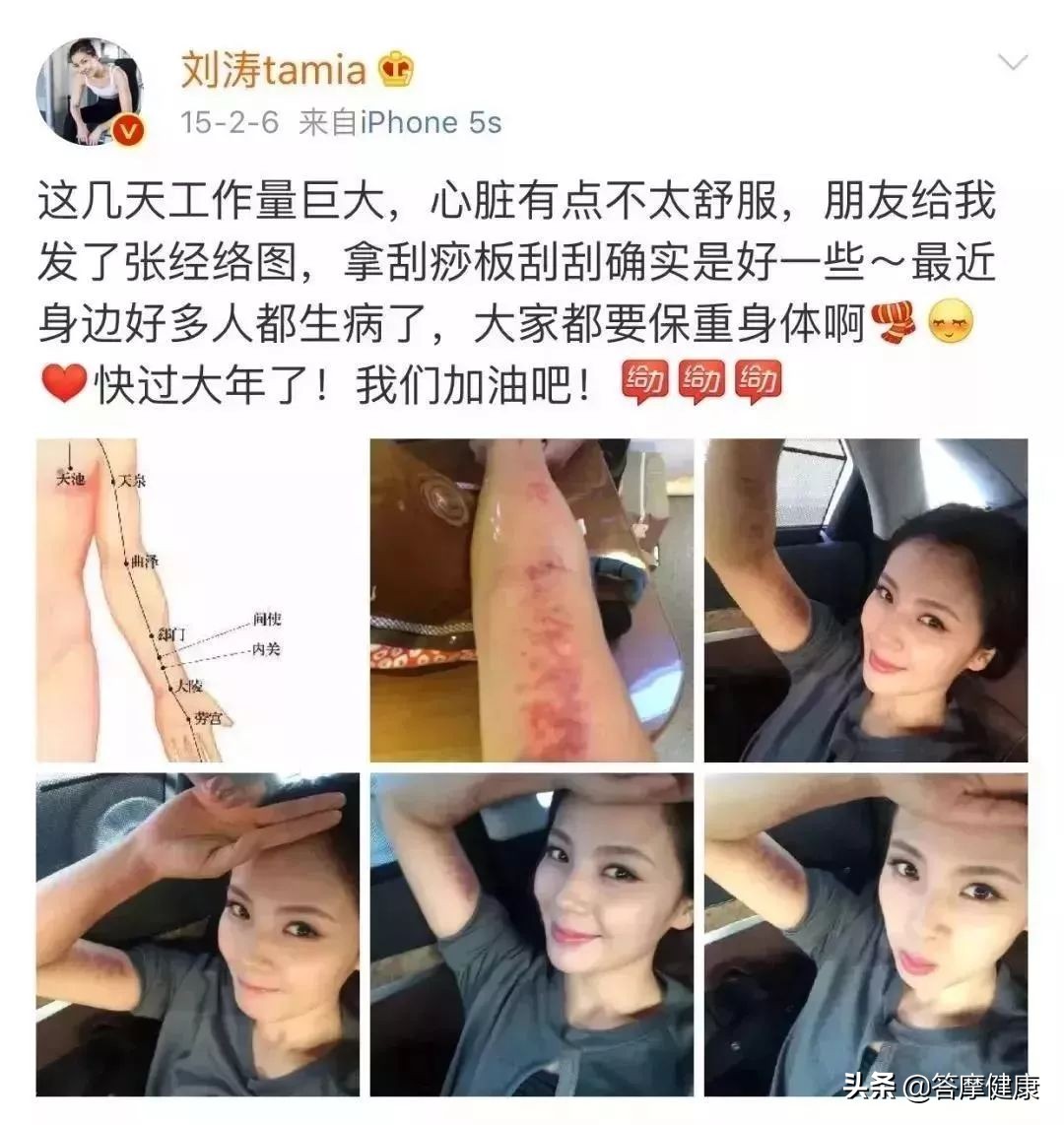 年过三十面部下垂，告诉你提拉紧致的秘技