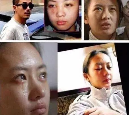 童瑶是张默殴打的人吗,童瑶被张默打是哪一年