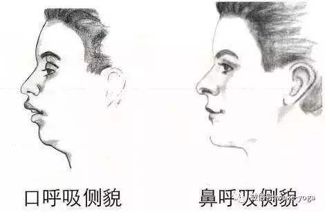 吃槟榔会让嘴唇变薄吗,吃槟榔会腮骨变宽