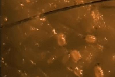 被痘痘践踏的自尊心有救了，坚持做好这五点，让你找回自信！