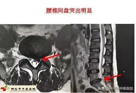 磁共振检查对身体有害吗,医院磁共振是检查什么的