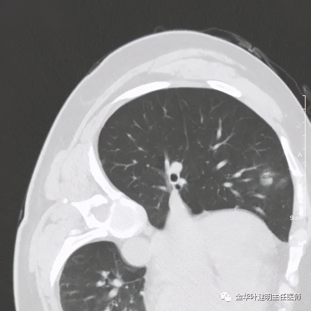 放个大招完整版教学,放个大招完整版前奏