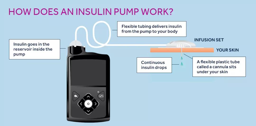 430亿美金并购案,美敦力收购