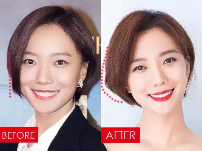 拯救发际线告别大额头,拯救发际线不走冤枉路