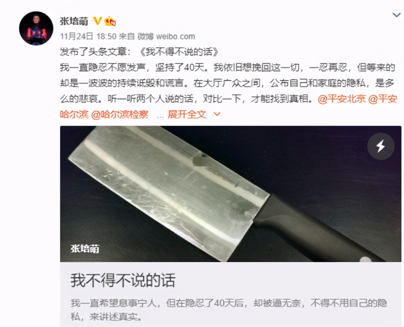张培萌100米跑赢苏炳添,张培萌飞人事件