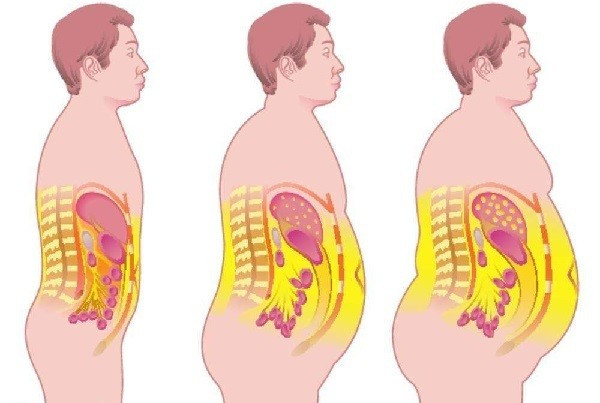 消除肚子内脏脂肪的最好方法,如何减掉内脏脂肪大肚腩