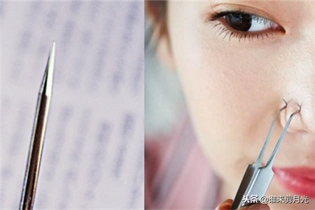 粉刺针去黑头粉刺的操作方法,粉刺针怎么去黑头图解