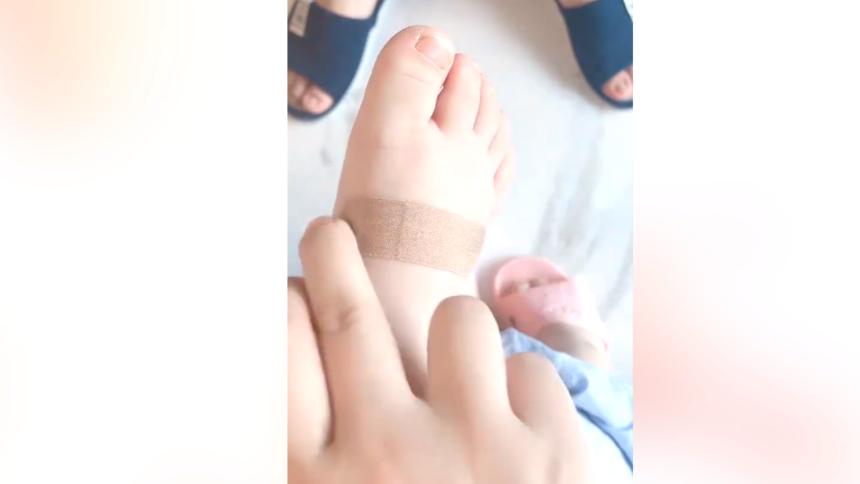 小孩不小心把脚划伤了多久能愈合,儿子的脚被刮伤了