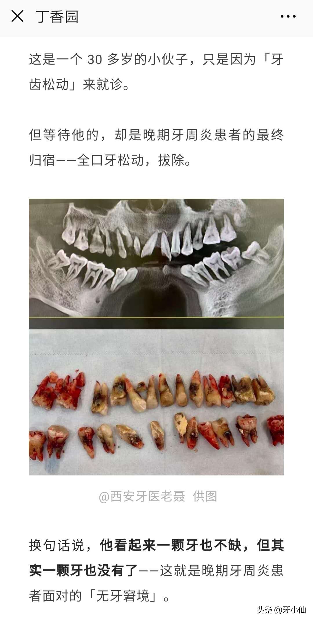 牙龈出血口臭跟牙齿不贴合,有个牙齿晃动牙龈出血口臭