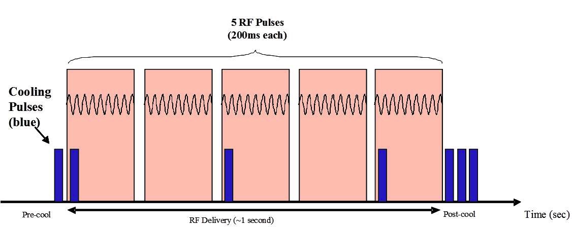 抗皱紧致热玛吉,家用热玛吉淡化皱纹提拉紧致