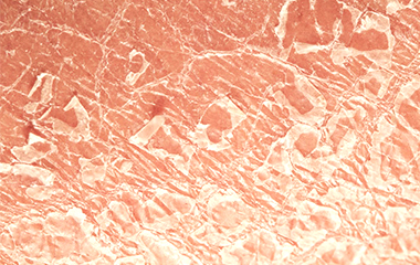 肺癌皮肤会出现哪些症状,肺癌发生时皮肤有什么异常表现