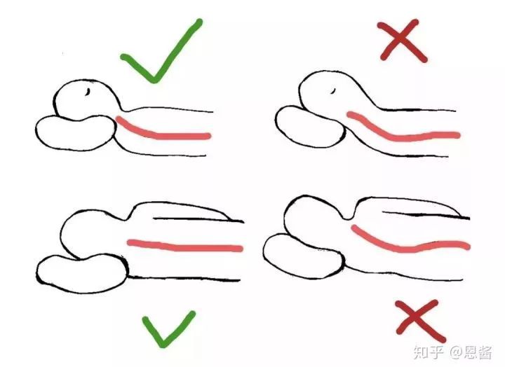有的人活着已经死了一半,有些人活着颈椎却已经死了