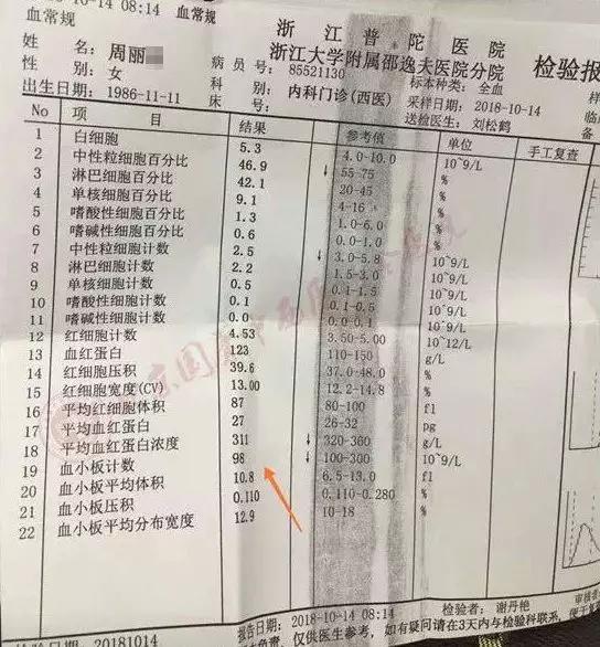 45岁女血小板偏高357要怎么降下来,35岁女性血小板452用不用治疗