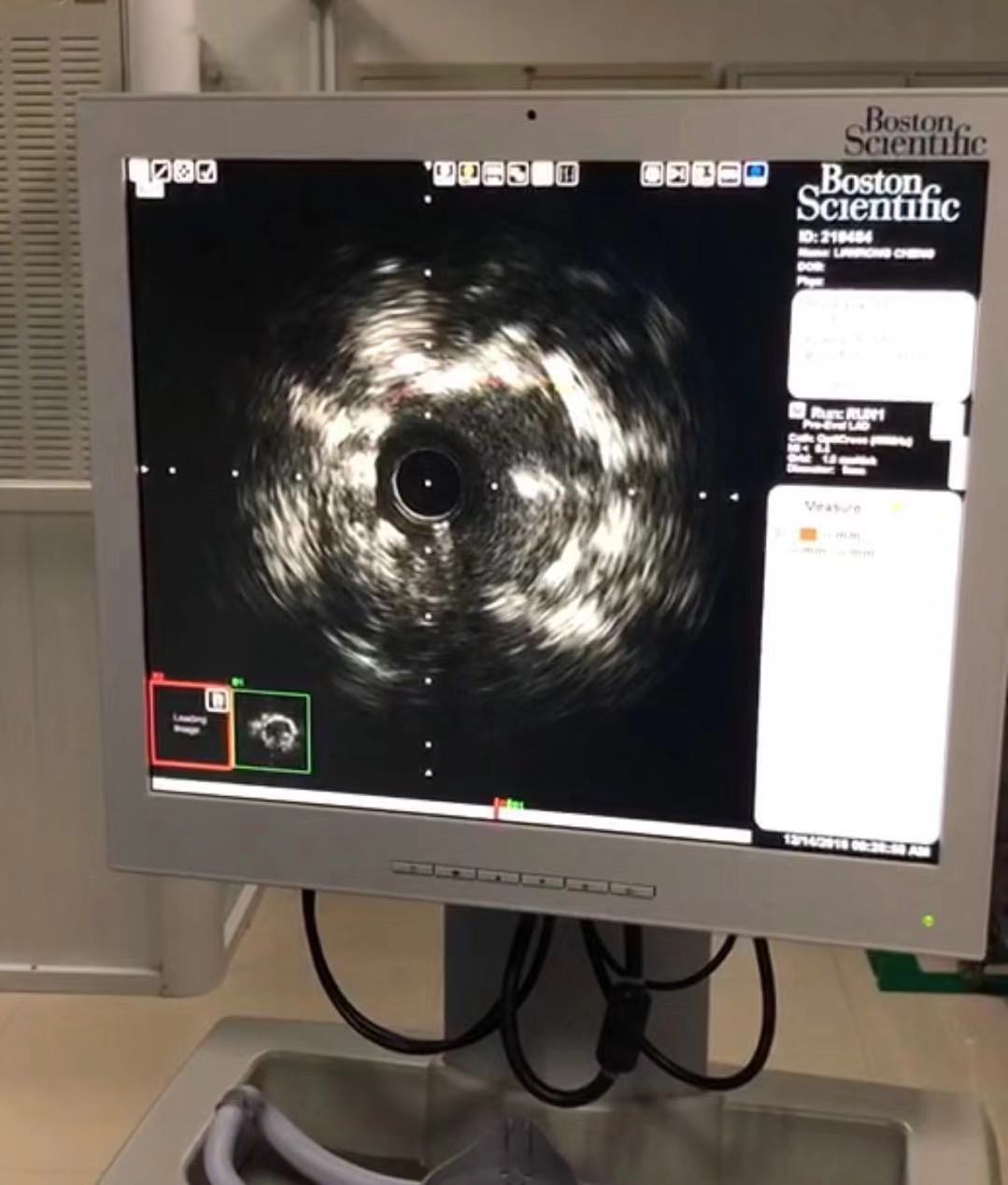 中心医院冠心病专家,冠心病重症病房