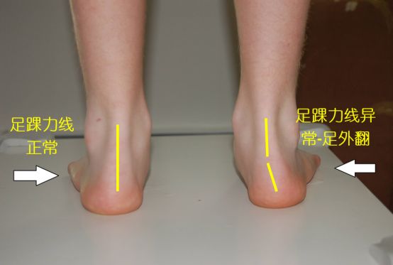 买跑鞋参考的几个要素,跑鞋鞋子尺码怎么选合适