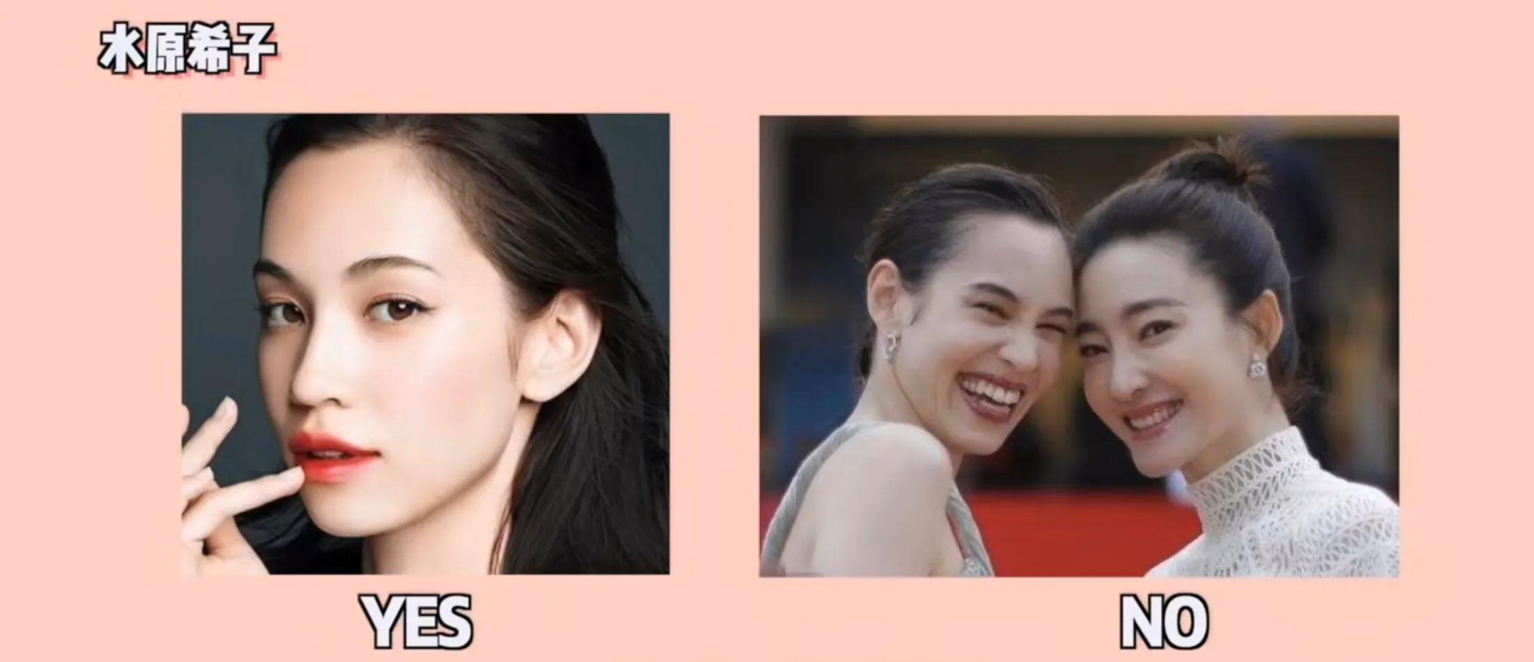 侧颜凸嘴怎么修,让侧脸变好看的方法