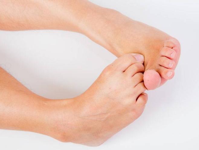 脚部出现这4种情况,脚部怎么能看出身体问题