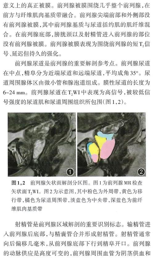 鍓嶅垪鑵簃ri褰卞儚瑙e墫,鍓嶅垪鑵簃ri瑙e墫