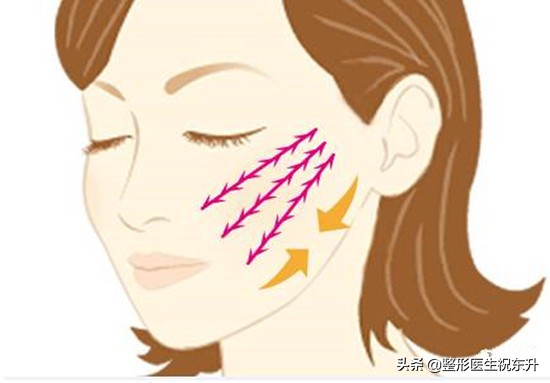 法令纹严重怎么办30岁,中年人怎么去除法令纹