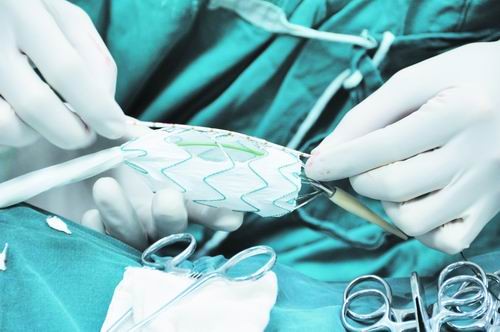 为什么说不锈钢可以植入人体,造福人类发明了什么