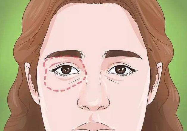 有黑眼圈怎么办如何消除黑眼圈,如果有黑眼圈了怎么去除黑眼圈