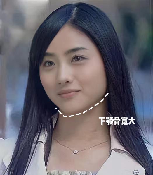 肉脸怎样改善脸型变好看,脸上肉多改善脸型