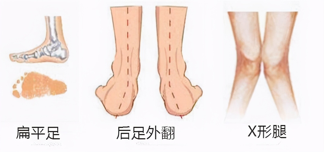 产后如何瘦脚最有效,产后怎么练脚变小