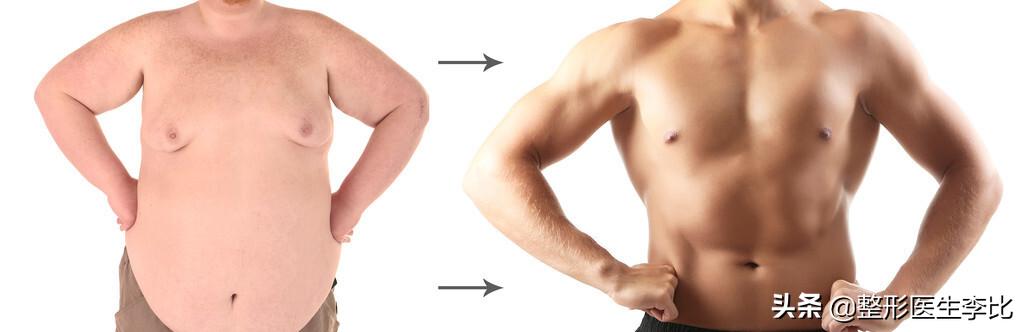 男性胸部发育有哪些症状,怎么判断男性胸部突然发育