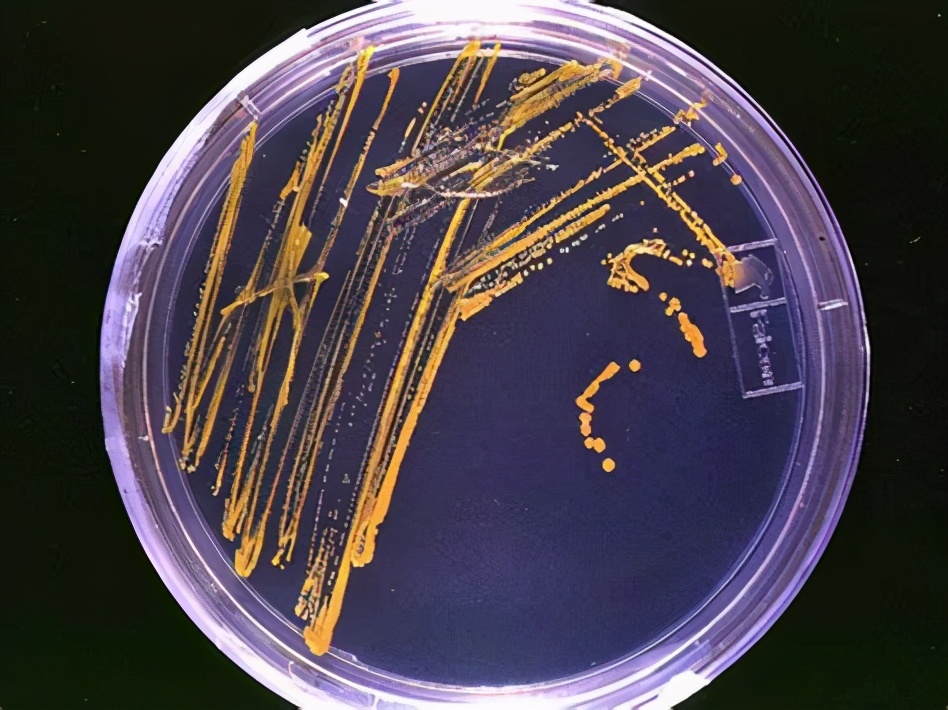 刷碗刷子长霉菌了怎么处理,刷碗布上的细菌