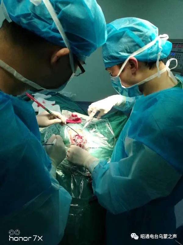 脑震荡应该注意事项,脑震荡需要什么休养方式保养