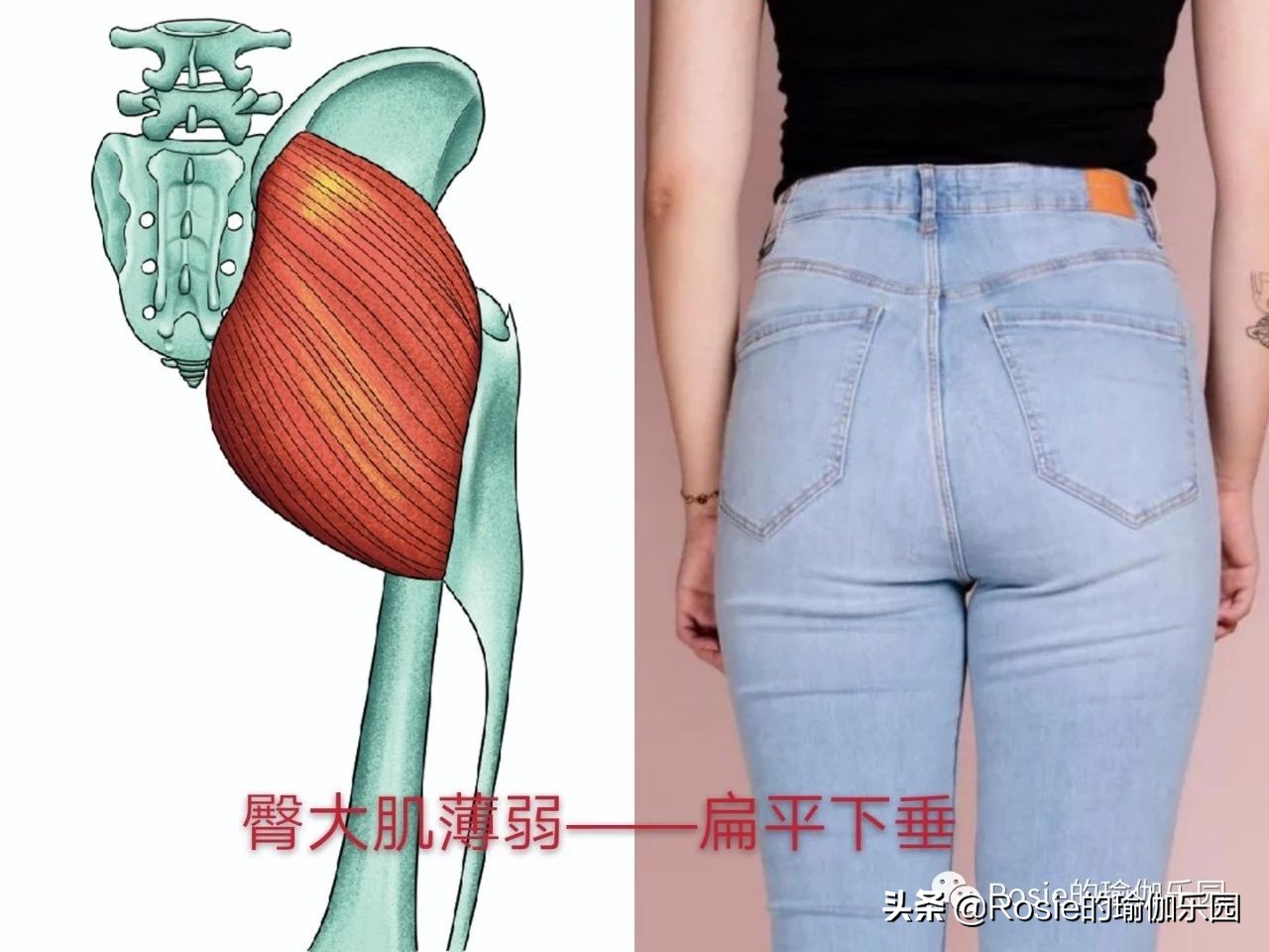 你以为你是翘臀其实是骨盆前倾,你以为的翘臀有可能是骨盆前倾