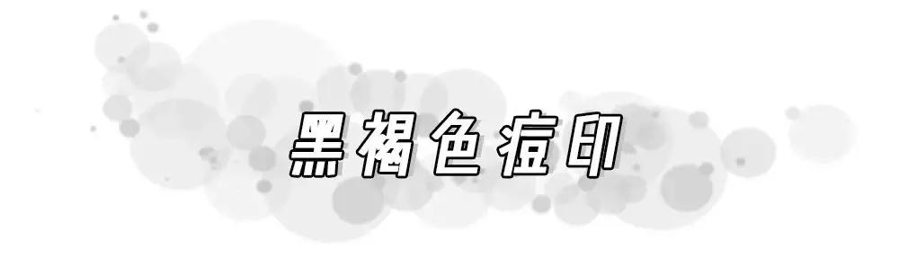 痘印根本治不住怎么办,痘印反反复复消不掉