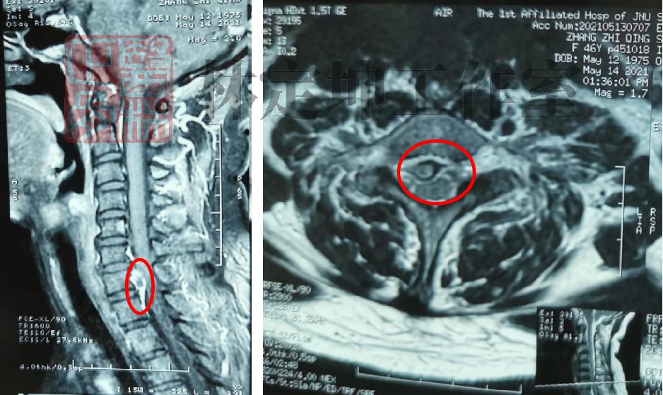 背痛中医如何调理,中医对背痛如何治疗