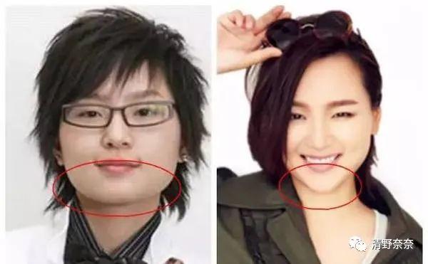 方脸短下巴难看,方圆脸怎么改善脸型下颚线高
