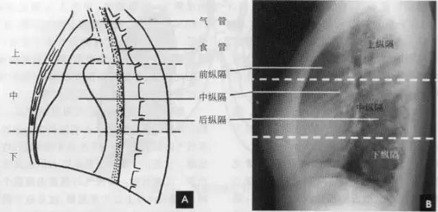 拿到胸片却不会看？送你7个窍门，手把手教你解读胸片（收藏）