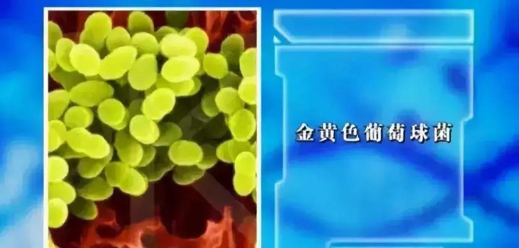 危险三角区会有什么症状,面部危险三角区有哪些危害